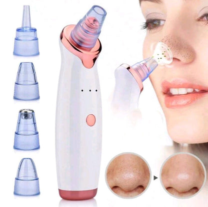 Facial Blackhead Remover Vacuum Pore Adsorber Electric Pimple Blackhead Cleaner USB Rechargeable Water Cycle Face Cleaning Tool